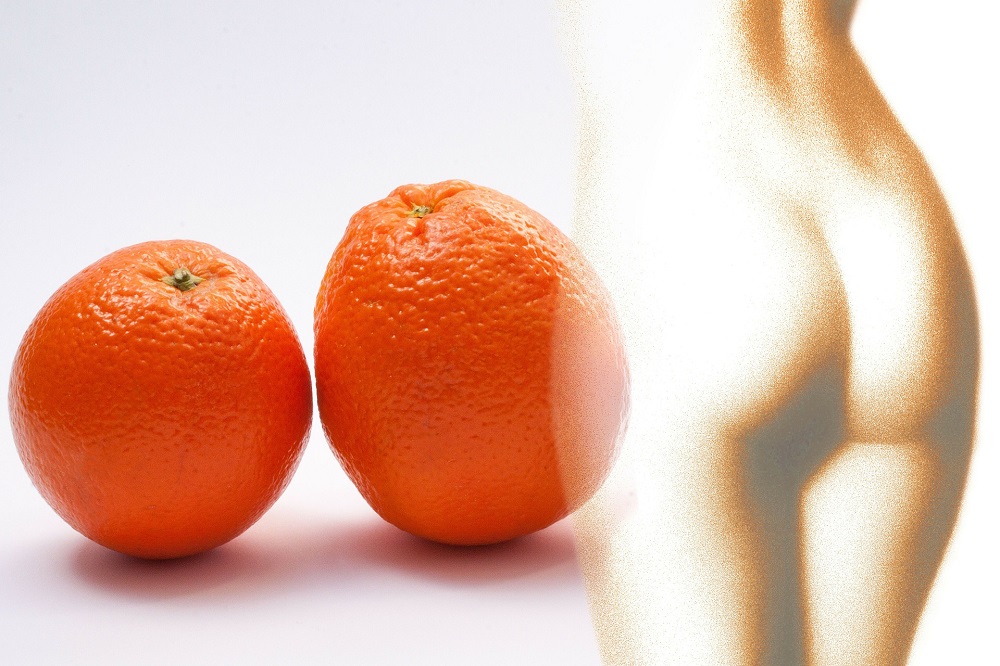 Celulit u prikazu naranče