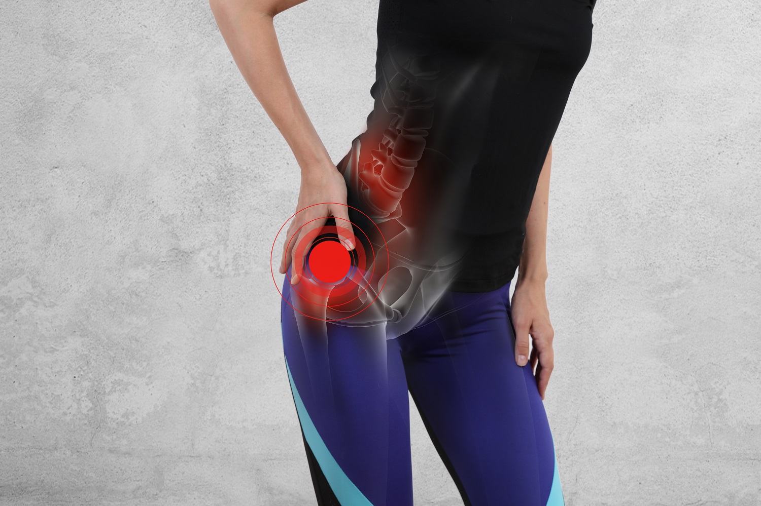 elektroforeza boli u zglobovima artritis i artroza liječenja koljena