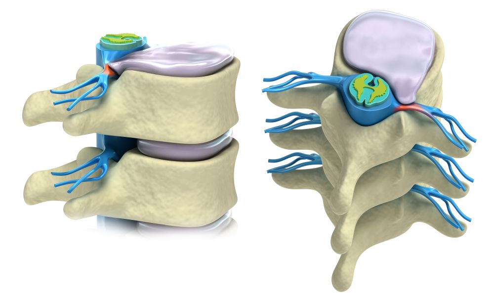 bolovi u donjem dijelu leđa daju se zglobovima