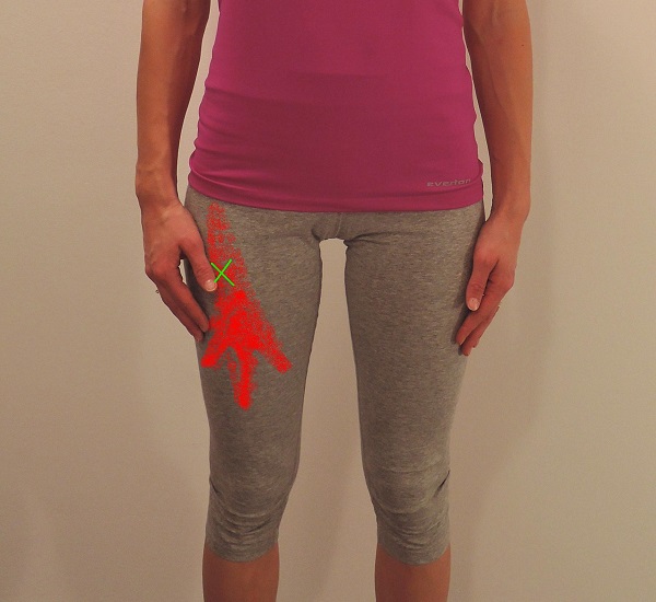 Prednja strana natkoljenice (Quadriceps)