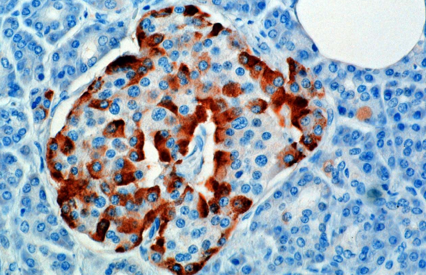 Glukagon