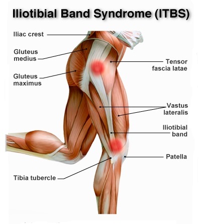 bolovi u mišićima iznad koljena