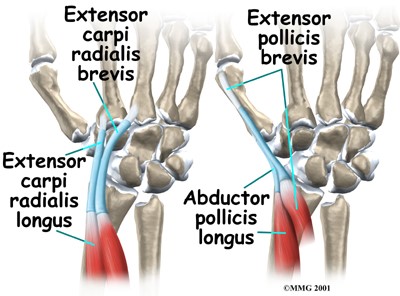 Bol i oteklina u području ručnog zgloba i podlaktice (tendinitis i tenosinovitis)